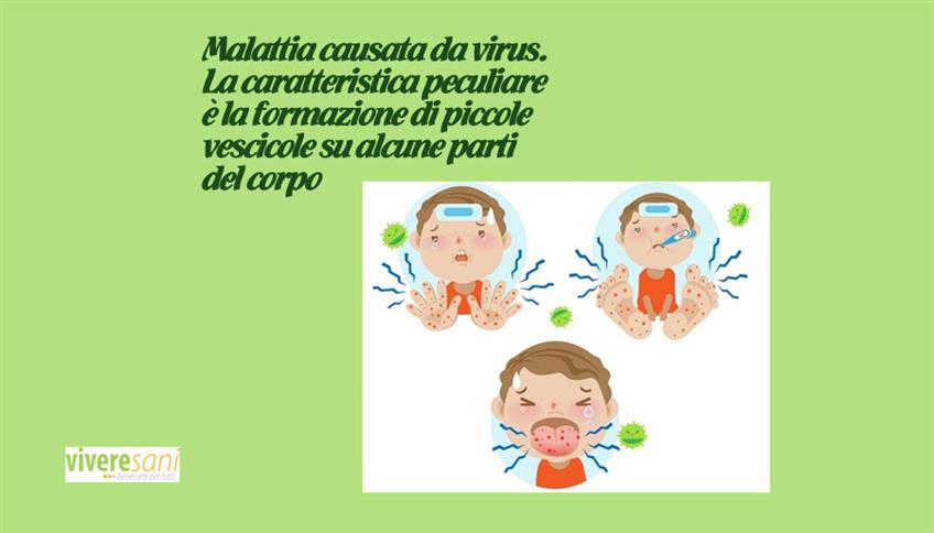 Bocca-mani-piedi Bocca-mani-piedi